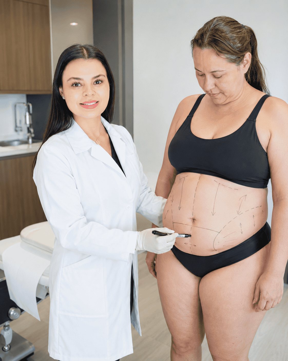 Lipomarcación Femenina realizada por la Dra. Nilser Santos en Santiago